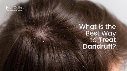 dandruff problem