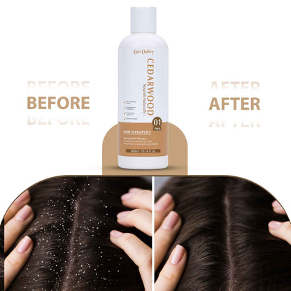 Cedarwood Shampoo for Dry Scalp Dandruff & Hair Fall