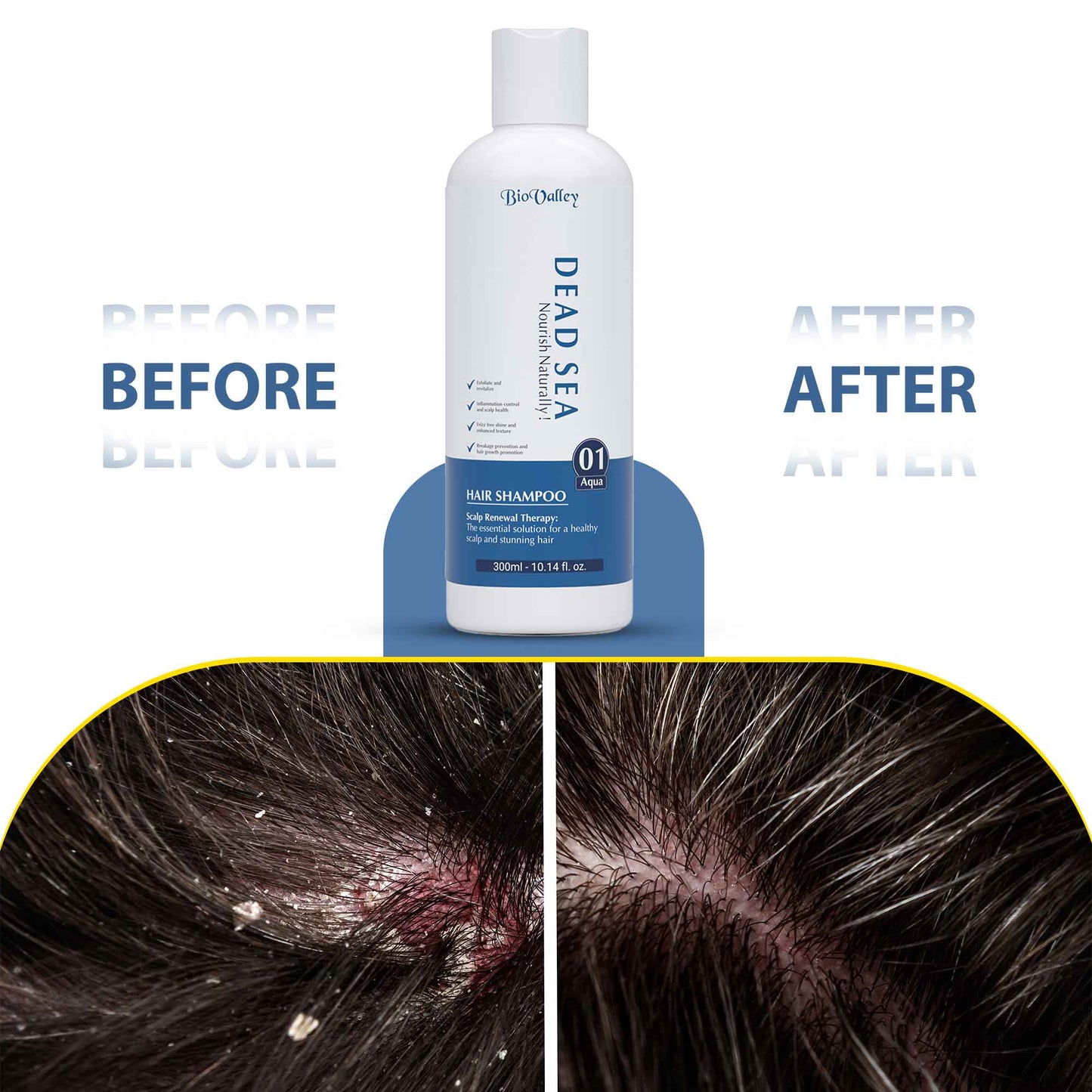 Dead Sea Shampoo for Oily Itchy Scalp & Dandruff