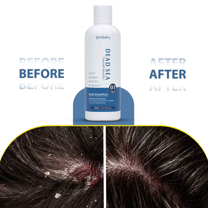 Dead Sea Shampoo for Oily Itchy Scalp & Dandruff